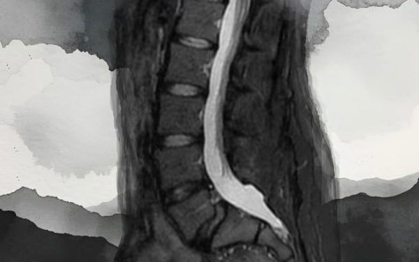 “Nadie te cuenta esto”: el libro que destapa la cara real del dolor crónico